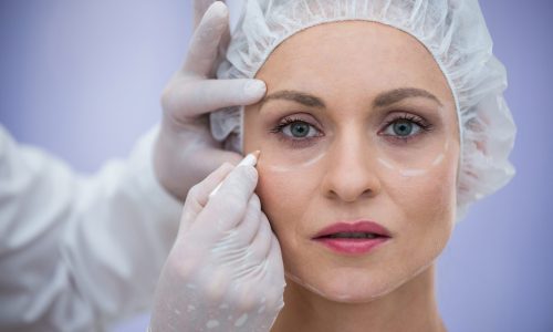 Close-up of doctor marking female patients face for cosmetic treatment